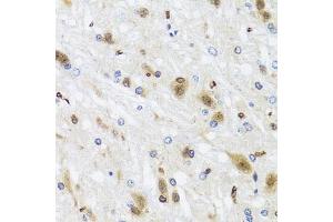 Immunohistochemistry (IHC) image for anti-Histone Deacetylase 4 (HDAC4) (AA 451-650) antibody (ABIN6141669)