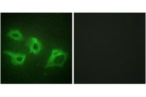 Immunofluorescence analysis of HeLa cells, using CKI-alpha Antibody.