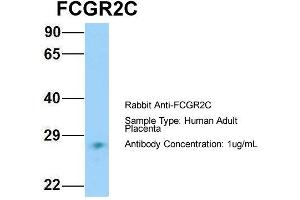 Host: Rabbit Target Name: FCGR2C Sample Type: Human Adult Placenta Antibody Dilution: 1. (FCGR2C antibody  (N-Term))