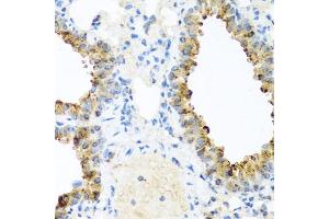 Immunohistochemistry of paraffin-embedded mouse lung using NIN antibody (ABIN6129422, ABIN6144630, ABIN6144632 and ABIN6224239) at dilution of 1:100 (40x lens). (Ninein antibody  (AA 1-287))
