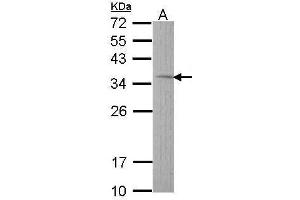 WB Image Sample (30 ug of whole cell lysate) A: Hep G2 , 12% SDS PAGE antibody diluted at 1:1000 (TST antibody)