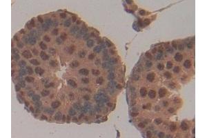 Immunohistochemistry (IHC) image for anti-CD2-Associated Protein (Cd2ap) (AA 368-623) antibody (ABIN7439519)