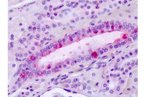 Anti-Latrophilin-3 / LPHN3 antibody IHC of human tonsil. (LPHN3 antibody  (C-Term))