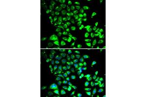 Immunofluorescence analysis of U20S cell using SSBP1 antibody. (SSBP1 antibody)