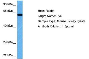 Host: Rabbit Target Name: FYN Sample Tissue: Mouse Kidney Antibody Dilution: 1ug/ml (FYN antibody  (Middle Region))