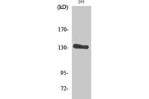 Western Blot analysis of 293 cells using ERBB2 Polyclonal Antibody at dilution of 1:2000. (ErbB2/Her2 antibody)