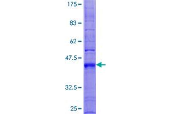 TM4SF4 Protein (AA 1-202) (GST tag)