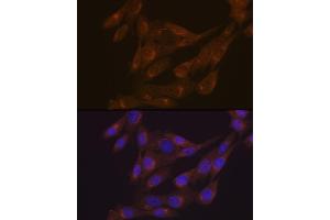 Immunofluorescence analysis of NIH-3T3 cells using PIST/GOPC Rabbit mAb (ABIN1678809, ABIN1678808, ABIN7101325 and ABIN7101326) at dilution of 1:100 (40x lens). (GOPC antibody)
