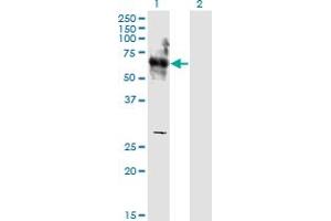 Western Blot analysis of SHC3 expression in transfected 293T cell line by SHC3 monoclonal antibody (M04), clone 1C11. (SHC3 antibody  (AA 381-480))