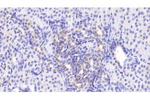 Detection of MAPK9 in Human Kidney Tissue using Polyclonal Antibody to Mitogen Activated Protein Kinase 9 (MAPK9) (JNK2 antibody  (AA 130-387))