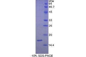 SDS-PAGE (SDS) image for Sema Domain, Immunoglobulin Domain (Ig), Short Basic Domain, Secreted, (Semaphorin) 3F (SEMA3F) (AA 350-483) protein (His tag) (ABIN1080790) (SEMA3F Protein (AA 350-483) (His tag))