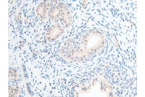 Immunohistochemistry (IHC) image for anti-Checkpoint Kinase 2 (CHEK2) (pThr68) antibody (ABIN6256592)