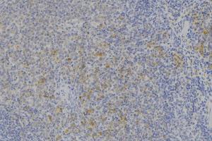 ABIN6273665 at 1/100 staining Human lymph node tissue by IHC-P. (IFNAR2 antibody  (C-Term))