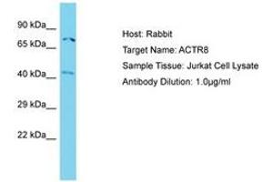 Image no. 1 for anti-ARP8 Actin-Related Protein 8 Homolog (ACTR8) (N-Term) antibody (ABIN6750738) (ACTR8 antibody  (N-Term))