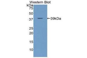 Western Blotting (WB) image for anti-Calcitonin (Calca) (AA 25-85) antibody (ABIN1172938) (Calcitonin antibody  (AA 25-85))