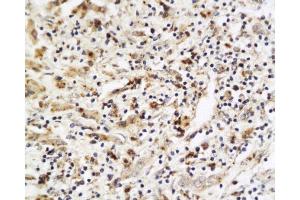 Immunohistochemistry (Paraffin-embedded Sections) (IHC (p)) image for anti-Placenta Growth Factor (PGF) (AA 166-221) antibody (ABIN727235) (PLGF antibody  (AA 166-221))