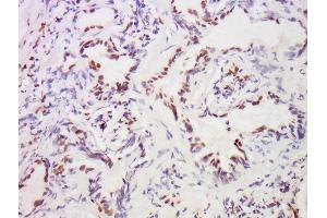 Immunohistochemistry (Paraffin-embedded Sections) (IHC (p)) image for anti-Macrophage Stimulating 1 (Hepatocyte Growth Factor-Like) (MST1) (AA 385-487) antibody (ABIN747308)