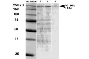 Western Blot analysis of Rat brain membrane lysate showing detection of LRP4 protein using Mouse Anti-LRP4 Monoclonal Antibody, Clone S207-27 . (LRP4 antibody  (AA 26-350) (PE))