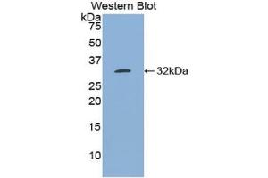 Detection of Recombinant Bcl3, Mouse using Polyclonal Antibody to B-Cell CLL/Lymphoma 3 (Bcl3) (BCL3 antibody  (AA 82-341))