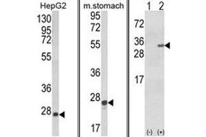 (LEFT) Western blot analysis of GSTA1 Antibody in HepG2 cell line lysates (35ug/lane).