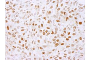 anti-Pleiotropic Regulator 1 (PLRG1) (AA 464-514) antibody