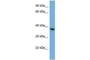 Host: Rabbit Target Name: TWF2 Antibody Dilution: 1. (TWF2 antibody  (N-Term))
