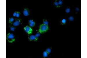 Anti-CALCOCO2 mouse monoclonal antibody (ABIN2453949) immunofluorescent staining of COS7 cells transiently transfected by pCMV6-ENTRY CALCOCO2 (RC203843). (CALCOCO2 antibody)
