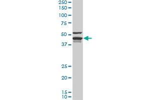 DNAJA4 monoclonal antibody (M01), clone 4B4-1F2. (DNAJA4 antibody  (AA 1-397))