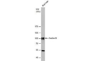 WB Image Factor B antibody [N2C2], Internal detects Factor B protein by western blot analysis. (Complement Factor B antibody)