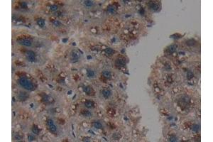 Detection of PSMD9 in Human Liver Tissue using Polyclonal Antibody to Proteasome 26S Subunit, Non ATPase 9 (PSMD9) (Proteasome 26S Subunit, Non ATPase 9 (AA 2-223) antibody)