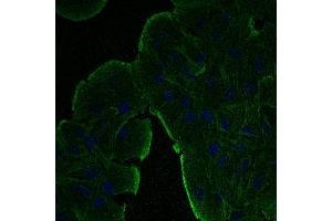 Immunofluorescence - anti-beta-Actin Ab at 1/100 dilution in NHl/3T3 cells, cells were fixed with methanol and permeabilized with 0. (beta Actin antibody  (N-Term))