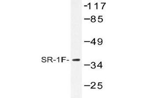Western blot (WB) analysis of SR-1F antibody in extracts from COS-7 cells.