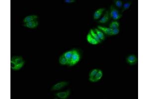 Immunofluorescence staining of HepG2 cells with ABIN7151234 at 1:66, counter-stained with DAPI. (TRAF7 antibody  (AA 1-90))