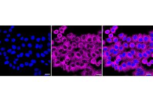 Immunocytochemical staining of HepG2 cells with CaMKII antibody (ABIN7797837), 1:1,000).