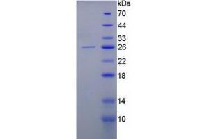 SDS-PAGE analysis of Human Keratin 8 Protein.