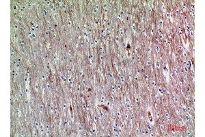 Immunohistochemical analysis of paraffin-embedded human-brain, antibody was diluted at 1:200 (ADAMTS18 antibody  (AA 1030-1110))