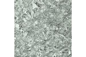 IHC on mouse brain (cryo section) using Rabbit antibody to Synaptotagmin 17  at a concentration of 50 µg/ml incubated overnight at 4C. (SYT17 antibody  (Internal Region))