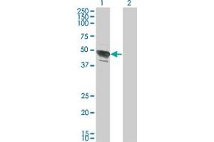 Western Blot analysis of TFAP2B expression in transfected 293T cell line by TFAP2B monoclonal antibody (M02), clone 2F6. (TFAP2B antibody  (AA 73-182))