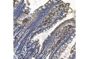 IHC analysis of LPP using anti LPP antibody (ABIN7602831). (LPP antibody  (C-Term))