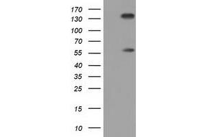 Western Blotting (WB) image for anti-Butyrophilin, Subfamily 1, Member A1 (BTN1A1) antibody (ABIN1496989) (BTN1A1 antibody)