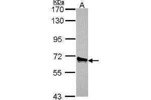 WB Image Sample (30 ug of whole cell lysate) A: A549 7. (ACOX3 antibody  (C-Term))
