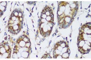 Immunohistochemistry of paraffin-embedded Human colon using ECH1 Polyclonal Antibody at dilution of 1:150 (40x lens).