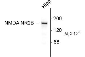 Western blots of 10 ug of rat hippocampal (Hipp) lysate showing specific immunolabeling of the ~180k NR2B subunit of the NMDA receptor. (GRIN2B antibody  (C-Term))