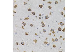 Immunohistochemistry of paraffin-embedded mouse brain using VEGFC antibody. (VEGFC antibody)