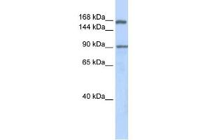 Human Lung; WB Suggested Anti-AFF2 Antibody Titration: 0. (AFF2 antibody  (Middle Region))