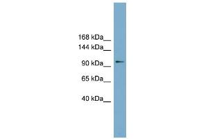 WB Suggested Anti-FTSJD1 Antibody Titration: 0. (CMTR2 antibody  (Middle Region))