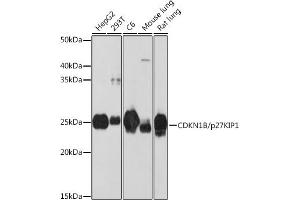 Western blot analysis of extracts of various cell lines, using CDKN1B/p27KIP1 antibody (ABIN7266602) at 1:1000 dilution.