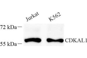 Western blot analysis of Cdkal1 (ABIN7073414) at dilution of 1: 400 (CDKAL1 antibody)