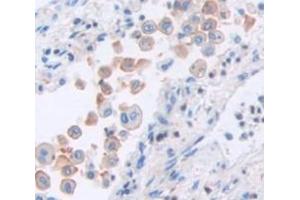 Figure. (Calsyntenin 2 antibody  (AA 31-271))