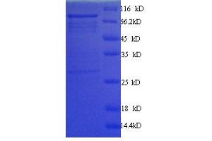 SDS-PAGE (SDS) image for Myc Proto-Oncogene protein (MYC) (AA 1-439) protein (His tag) (ABIN1047411)